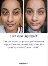 Load image into Gallery viewer, Skin Hero Bio-Retinol Serum